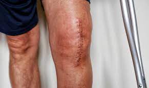 Knee problems